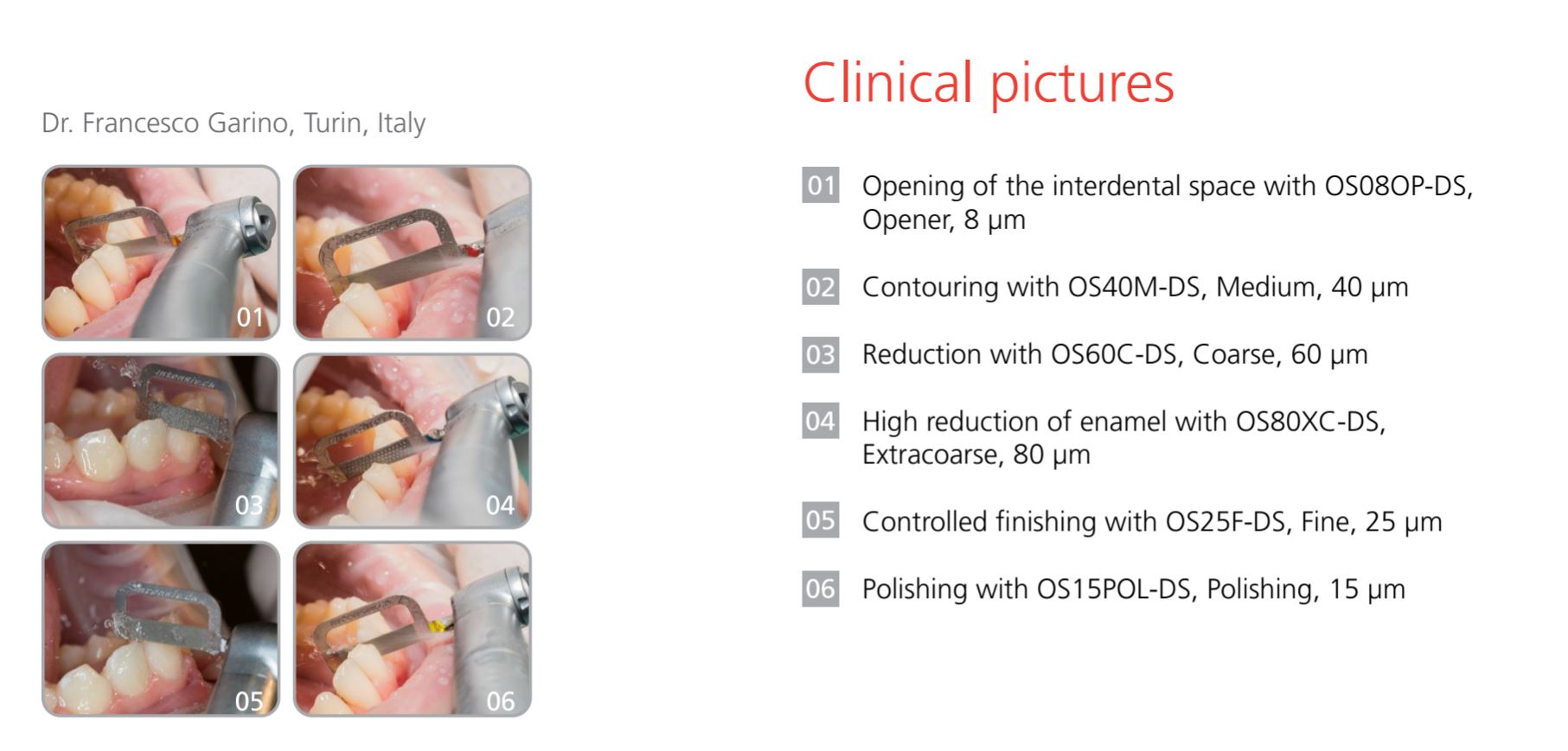 Thumbnail for Intensiv Ortho strip Opener Right Side Coated