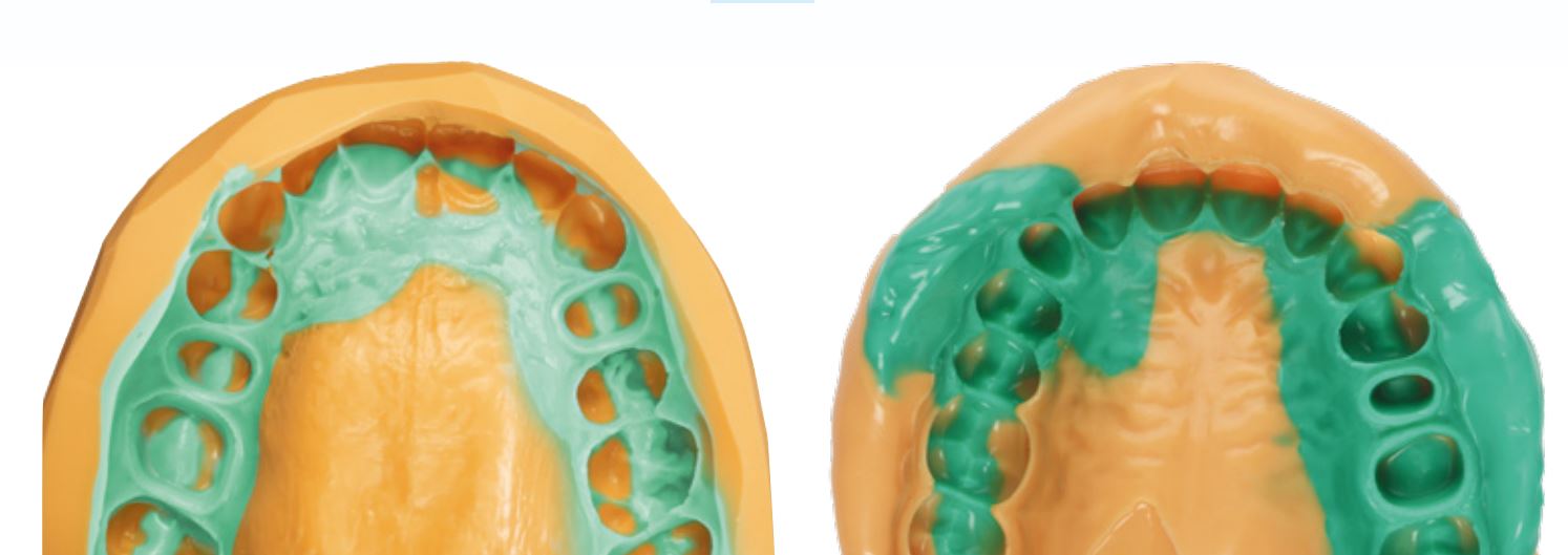 Thumbnail for Panasil Initial Contact Light Fast Normal Pack