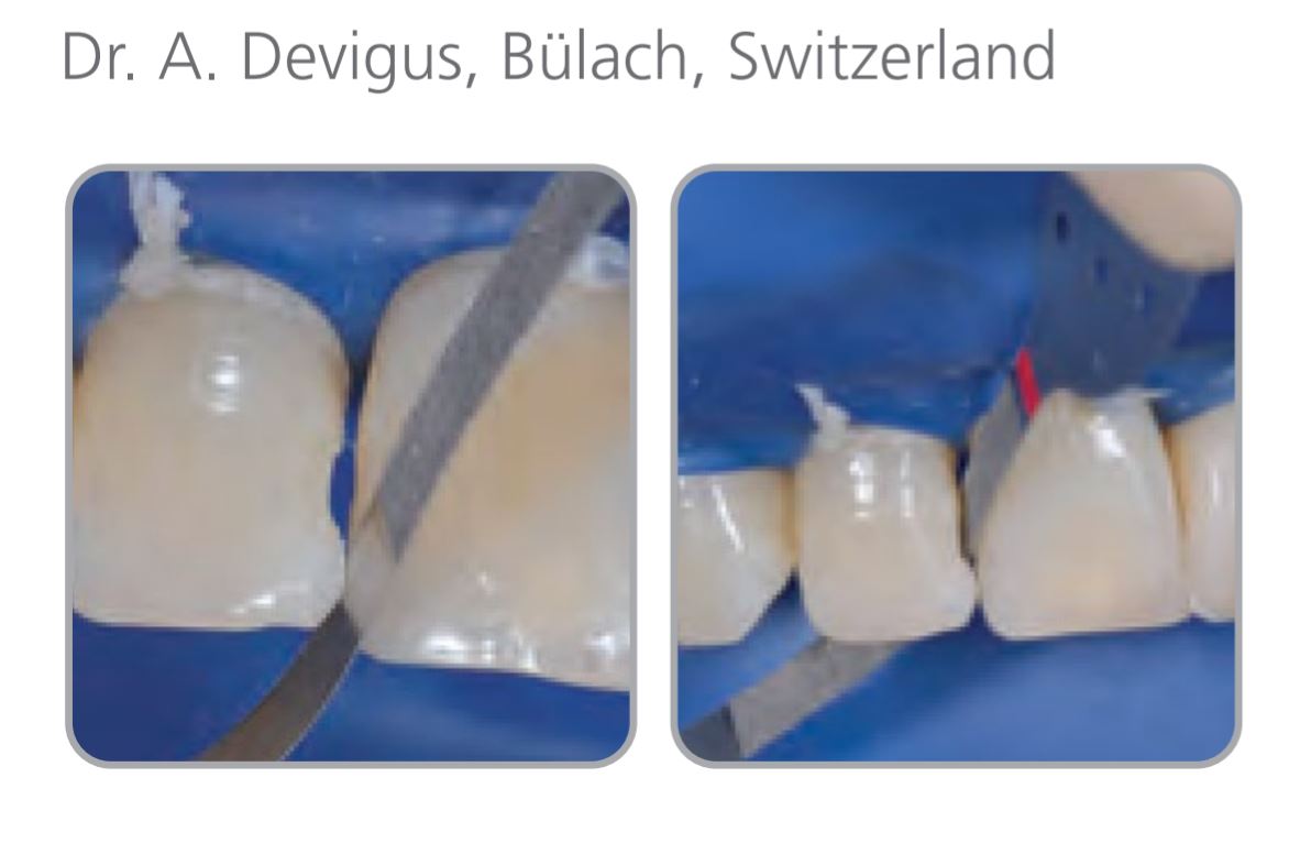 Thumbnail for Intensiv Proxo Strip