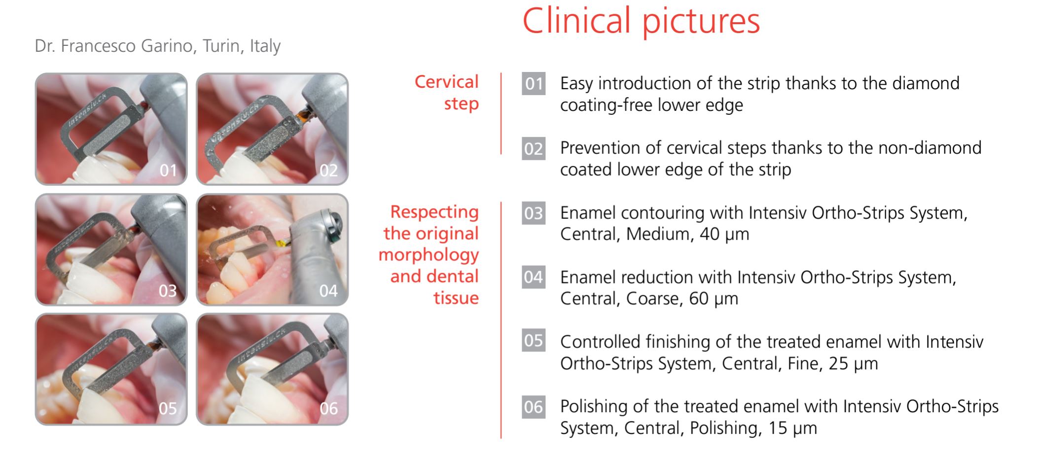 Thumbnail for Intensiv Ortho-Strips System (OP, XC &amp; Central Right-Sided)