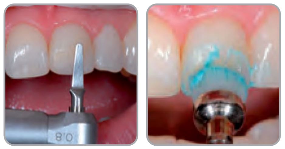 Thumbnail for Intensiv Unigloss Paste