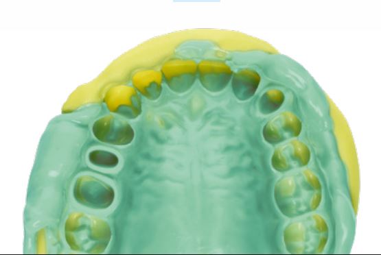 Thumbnail for Panasil Initial Contact Regular Normal Pack