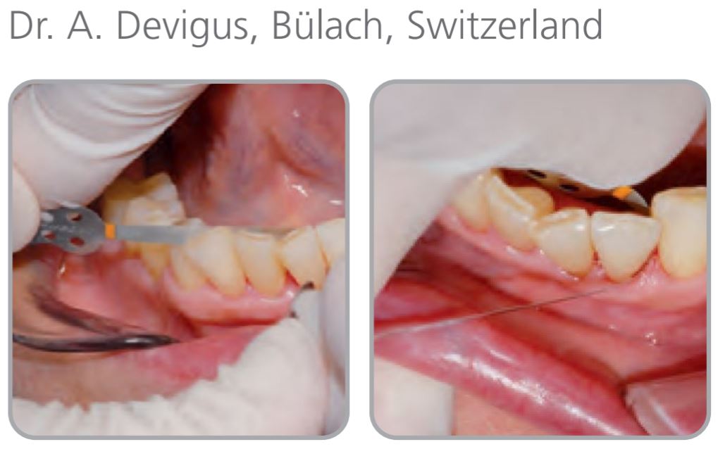 Thumbnail for Intensiv Proxo Polish