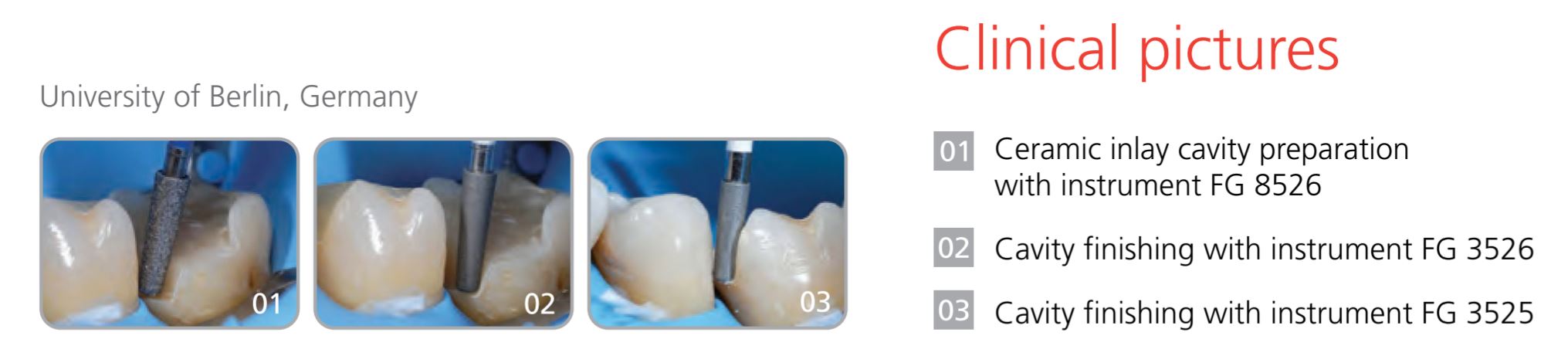 Thumbnail for Intensiv Cerinlay Set