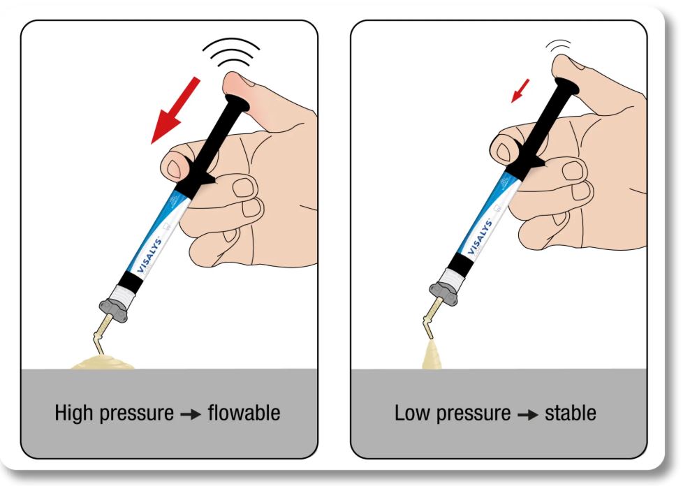 Thumbnail for Visalys Core Syringe Dentine Intro Pack