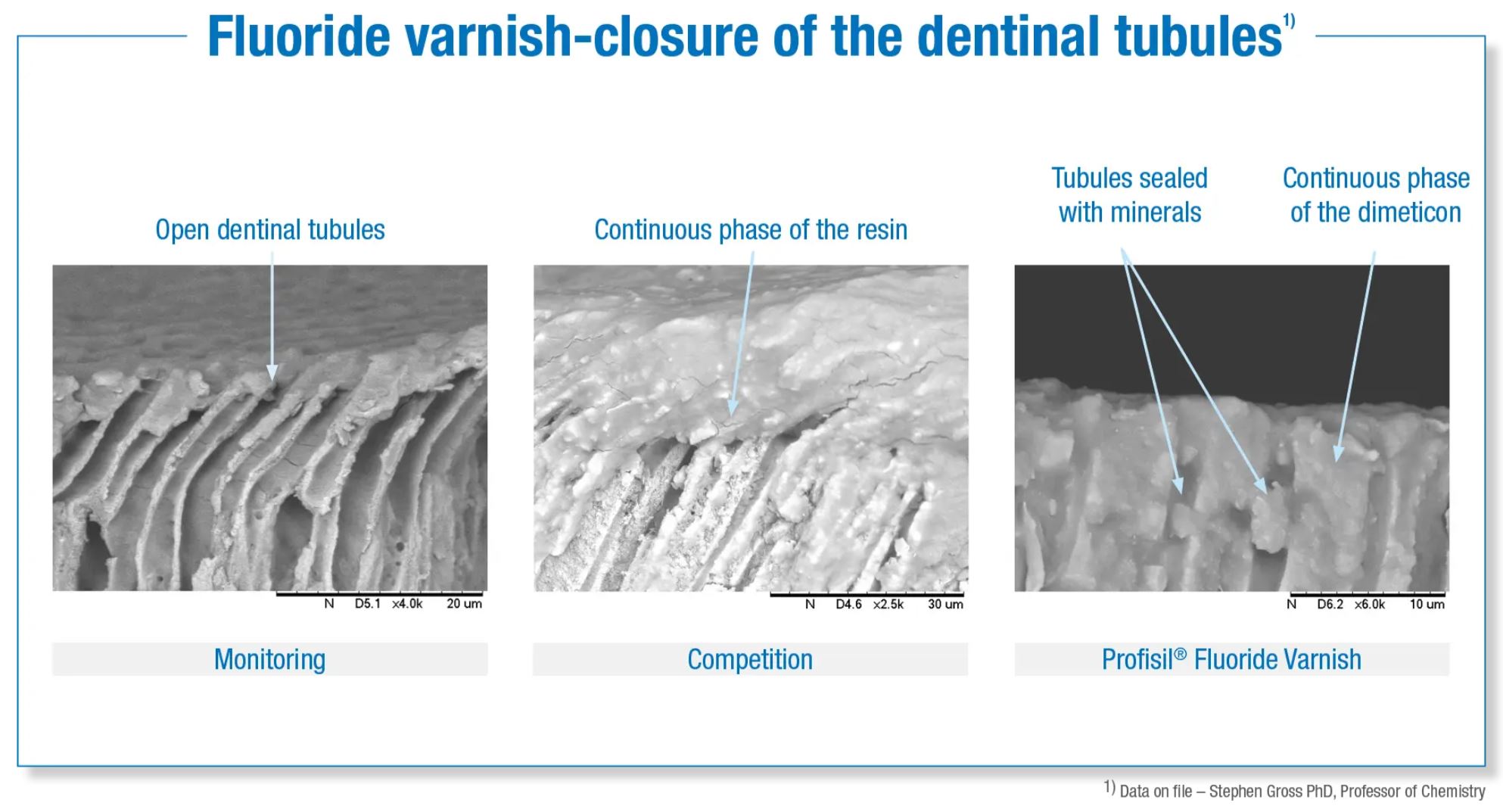 Thumbnail for Profisil Floride Varnish Unflavored Normal Pack